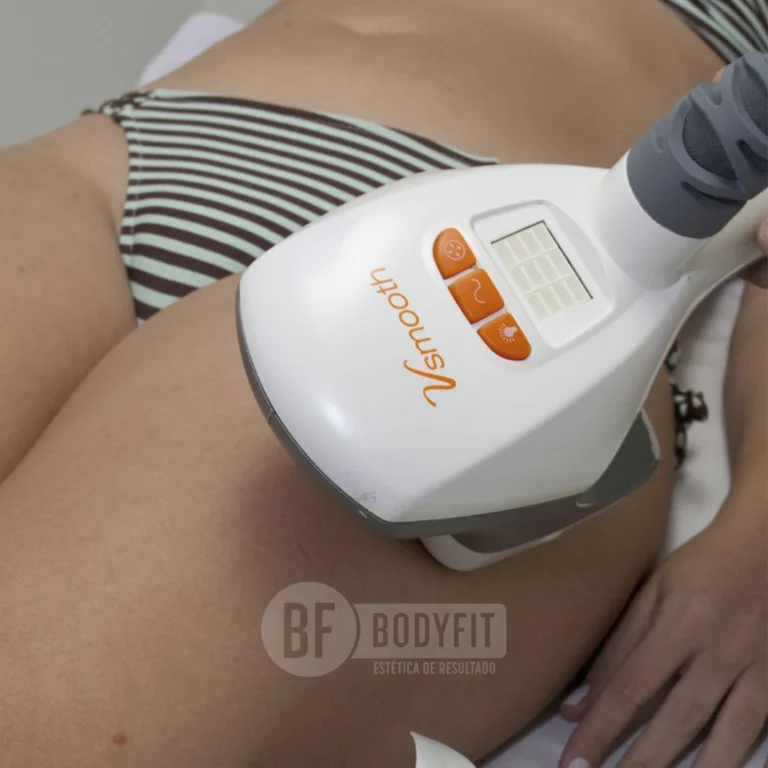 vela shape plus