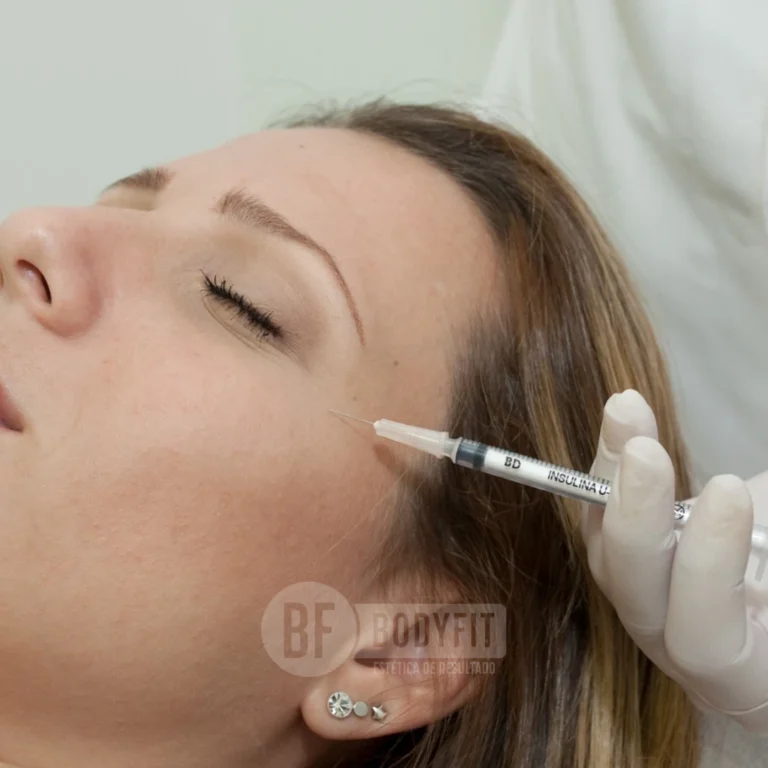 botox