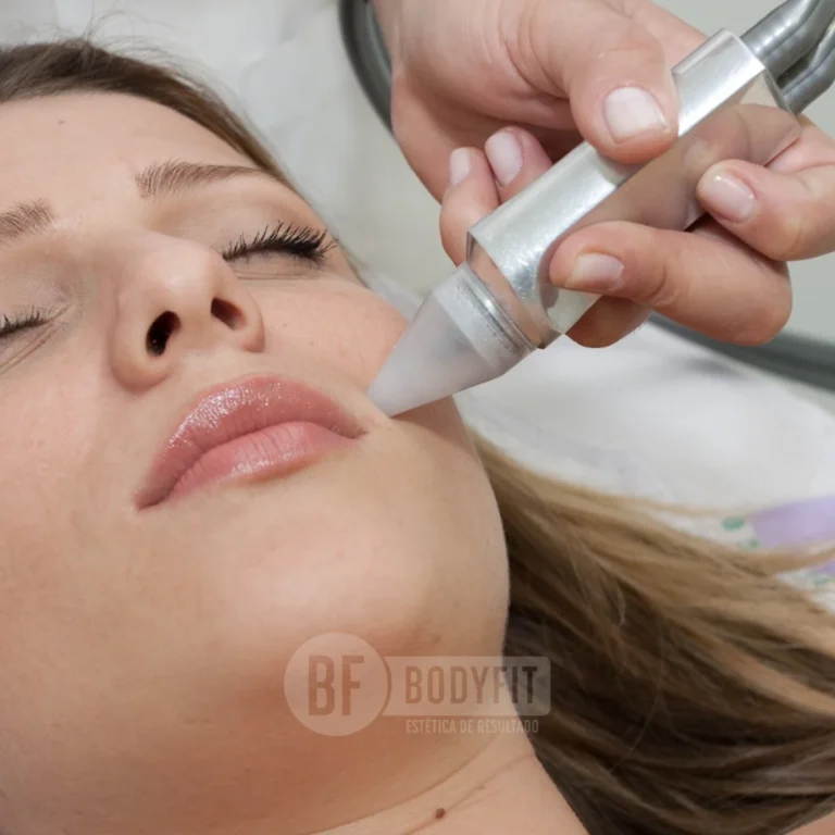 peeling de cristal