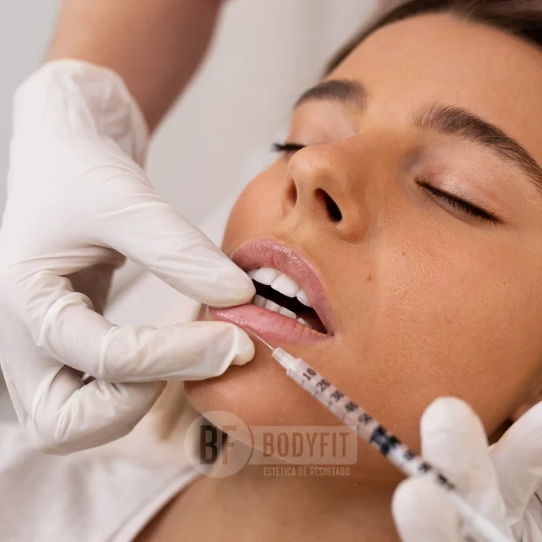 preenchimento labial