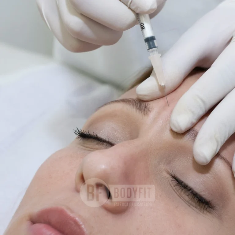 botox