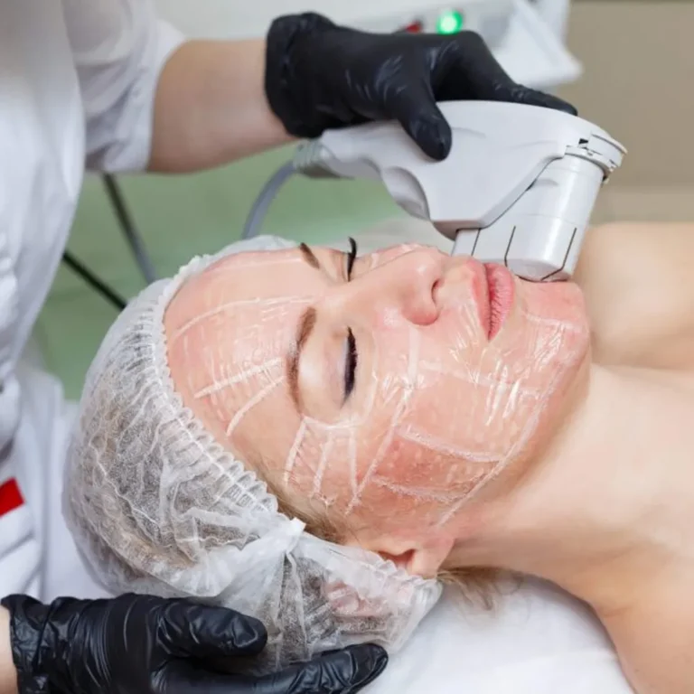 ultrassom microfocado